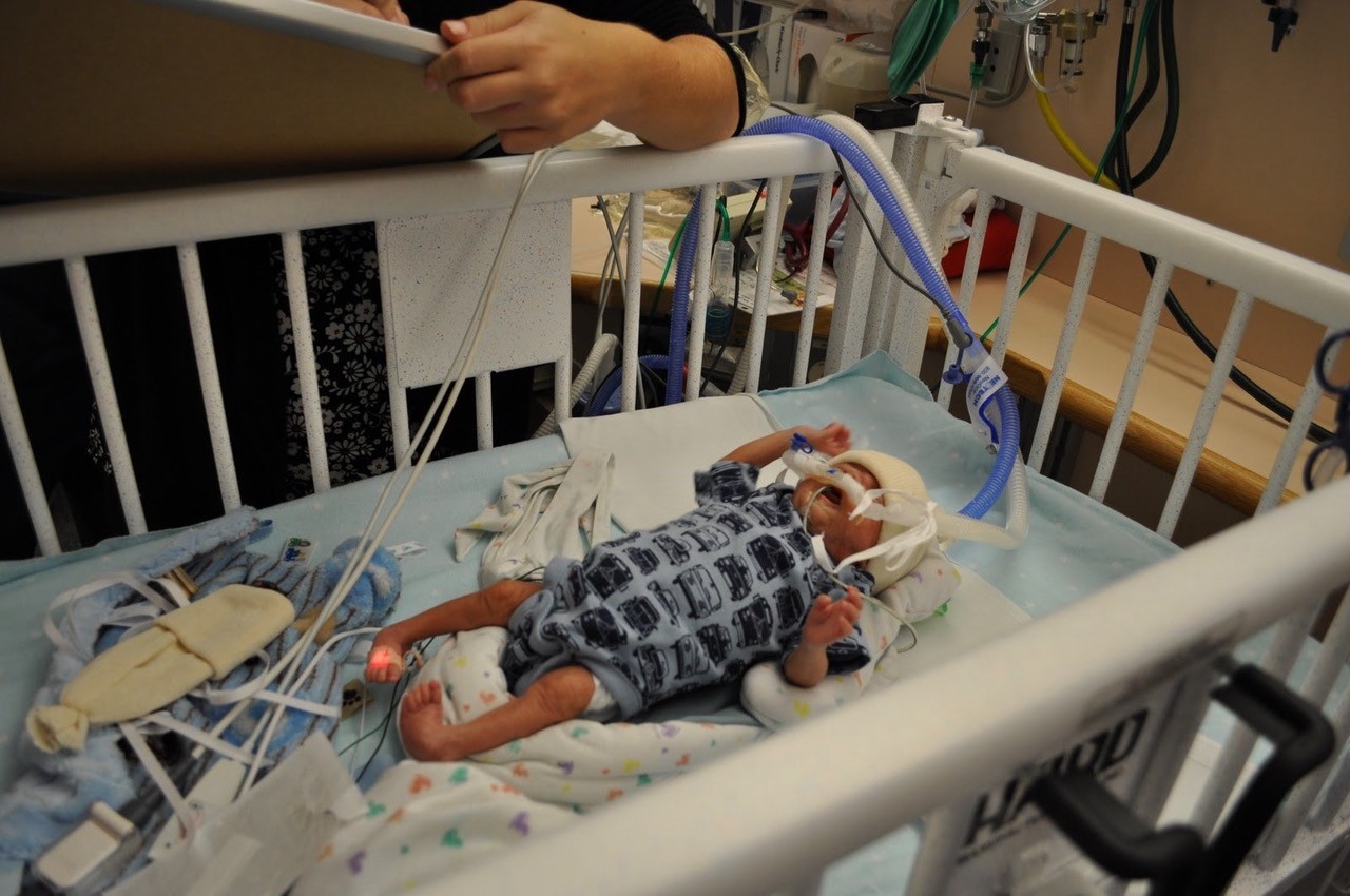 Elliot was born three months premature, weighing only one pound, nine ounces.